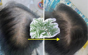 A Simple Natural Remedy for Hair Loss, Receding Hairlines, Alopecia, and Premature Graying